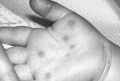 تصویر بندانگشتی از نسخهٔ مورخ ‏۲۱ مهٔ ۲۰۱۷، ساعت ۰۵:۴۶